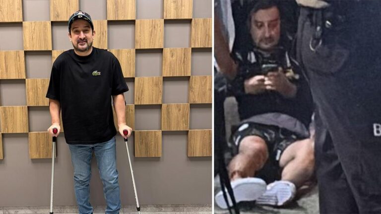 Yayından sonra ayağından vuruldu! Serhat Akın'dan 3 ay sonraki paylaşım…