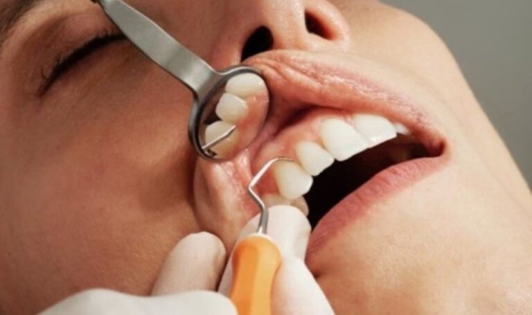 Diş çürüğü sorunu olanlar dikkat: O hastalığı tetikliyor! – Son Dakika Sağlık Haberleri